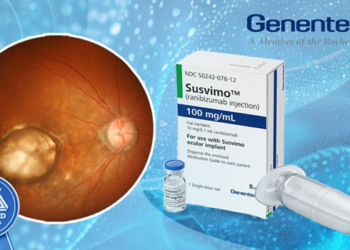 داروی Susvimo برای ادم ماکولا دیابتی